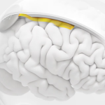 Neuralink Rival Precision Neuroscience’s Minimally Invasive Layer 7 Cortical Interface Cleared by The FDA